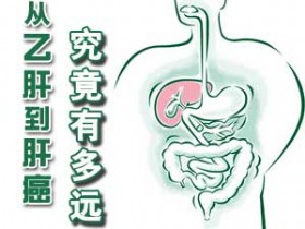 从乙肝到肝癌究竟有多远