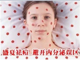 夏季长痘痘了怎么办